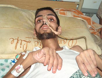 Mahmoud Abu Taha at the European Hospital in Gaza. Photo: Muhammad Sabah , B'Tselem. 