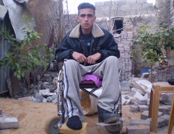 Muhammad Salim after the incident. Photo: 'Abd al-Karim Sa'adi. Photo: B'Tselem.