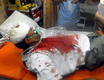 ‘Ali Hussein ‘Ali, whose skull was fractured, at the hospital in Nablus, 1 June 2009. Photo: Zakariya Sida, Rabbis for Human Rights