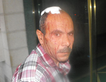 Photo: Yihya Sideh after the incident. Phoso: Zakariya Sideh, Rabbis For Human Rights, 1.6.09.