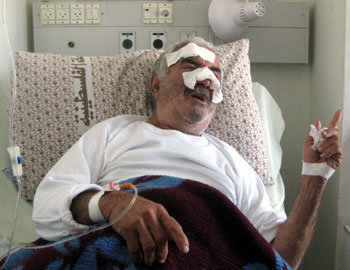 Ahmad Ghanem at the hospital in Tulkarm. Photo: 'Abd al-Karim a-Sa'adi, B'Tselem, 2 Dec. '09.