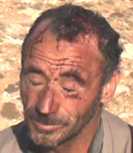 Khaled Najar after the incident. Photo: Nasser a-Nawaj&rsquo;ah, B'Tselem