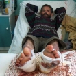 <p>[4623] 19  Razkallah al-Misri  in the hospital with broken feet following a beating by Border Police officers.</p><p>Photo credit: Iyad Hadad, B'Tselem</p>