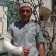 <p>[5368] 7  Palestinian from Yatta who was beaten by a Border Police officer at his work in Israel.</p><p>Photo credit: Musa Abu Hashhash, B'Tselem</p>