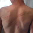 <p>[4370] 29  Allah Ahmad Ismail Taher, beaten by Border Police officers on 26 April 2004.</p><p>Photo credit: Nidal Kana’ane, B'Tselem</p>