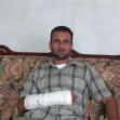 <p>[7842] 1  Naim Ishtiyeh, 34, from Sallem, Nablus District. On 10 July 2006, an Israeli soldier beat him with a stick near 'Asira a-Shamaliya, breaking his wrist.</p><p>Photo credit: Salma a-Dib’i, B'Tselem</p>
