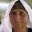 <p>[9715] 11  Tamam a-Nawaj'ah, from Susiya, who was assaulted by settlers on 8 June 2008.</p><p>Photo credit: Sarit Michaeli, B'Tselem</p>