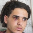 <p>[9948] 14  Ahmad Abu Jamal, a resident of East Jerusalem, was beaten by security guards and Border Police near the prime minister's residence in West Jerusalem, 11 August 2008. </p><p>Photo credit: Kareem Jubran, B'Tselem</p>