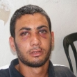 <p>[9949] 14  Ihab Abu Najma, a resident of East Jerusalem, was beaten by security guards and Border Police near the prime minister's residence in West Jerusalem, 11 August 2008.  </p><p>Photo credit: Kareem Jubran, B'Tselem</p>