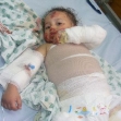<p>[10314] 9 Jan Operation Cast Lead: The infant Farah Abu Halima, who was severely burned on 3 January 2009, when the army fired phosphorous shells at her house. Her mother died from her wounds, on 23 September 2009, at a hospital in Egypt.</p><p>Photo credit: Muhammad Sabah, B'Tselem</p>