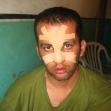 <p>[10615] 17  Ashraf Shalaldeh, construction worker, from Sa'ir, Hebron District, was severely beaten by Border Police and suffered a broken nose, when he tried to enter Jerusalem to work without an entry permit. </p><p>Photo credit: Musa Abu Hashhash, B'Tselem</p>