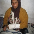 <p>[10692] 31  Halima a-Shawarmeh, 57, stated that, on 11 March 2009, Border Police assaulted her as she approached the Separation Barrier to get her donkey. They tried to take the donkey, and one of them hit her with his rifle, breaking her arm.</p><p>Photo credit: Musa Abu Hashhash, B'Tselem</p>