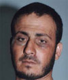 Wahid a-Rawidi the day after the incident. Photo: Suad Abu Ramuz