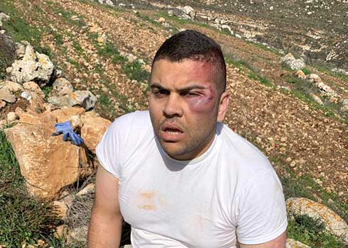 Rashed Tawafshah after he was assaulted. Photo courtesy of the witness 