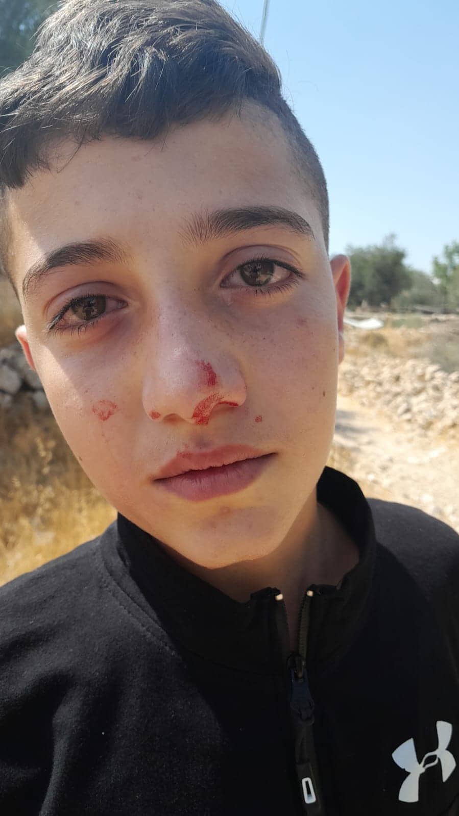 Islam-Tamimi after being assaulted. Photo courtesy of the family 