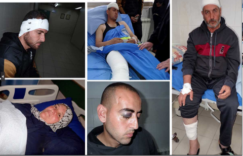 أبناء عائلة المشني بعد الاعتداء عليهم، من اليمين إلى اليسار ومن أعلى إلى أسفل: عائد المشني، محمد المشني، حامد المشني، عمر المشني وعفاف المشني. 