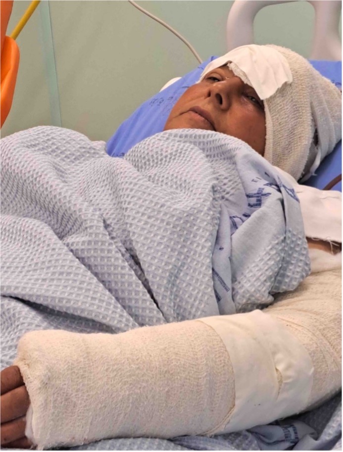  Hajar Ka’abneh in hospital. Photo: Iyad Hadad, B'Tselem 