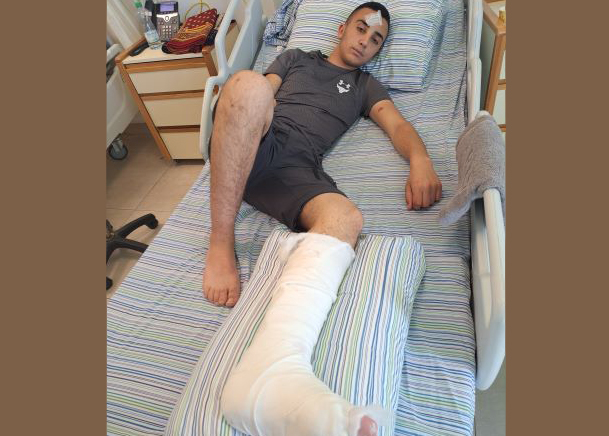 Caption: Muhammad Shreiteh in hospital after being attacked. Photo: Iyad Hadad, B'Tselem