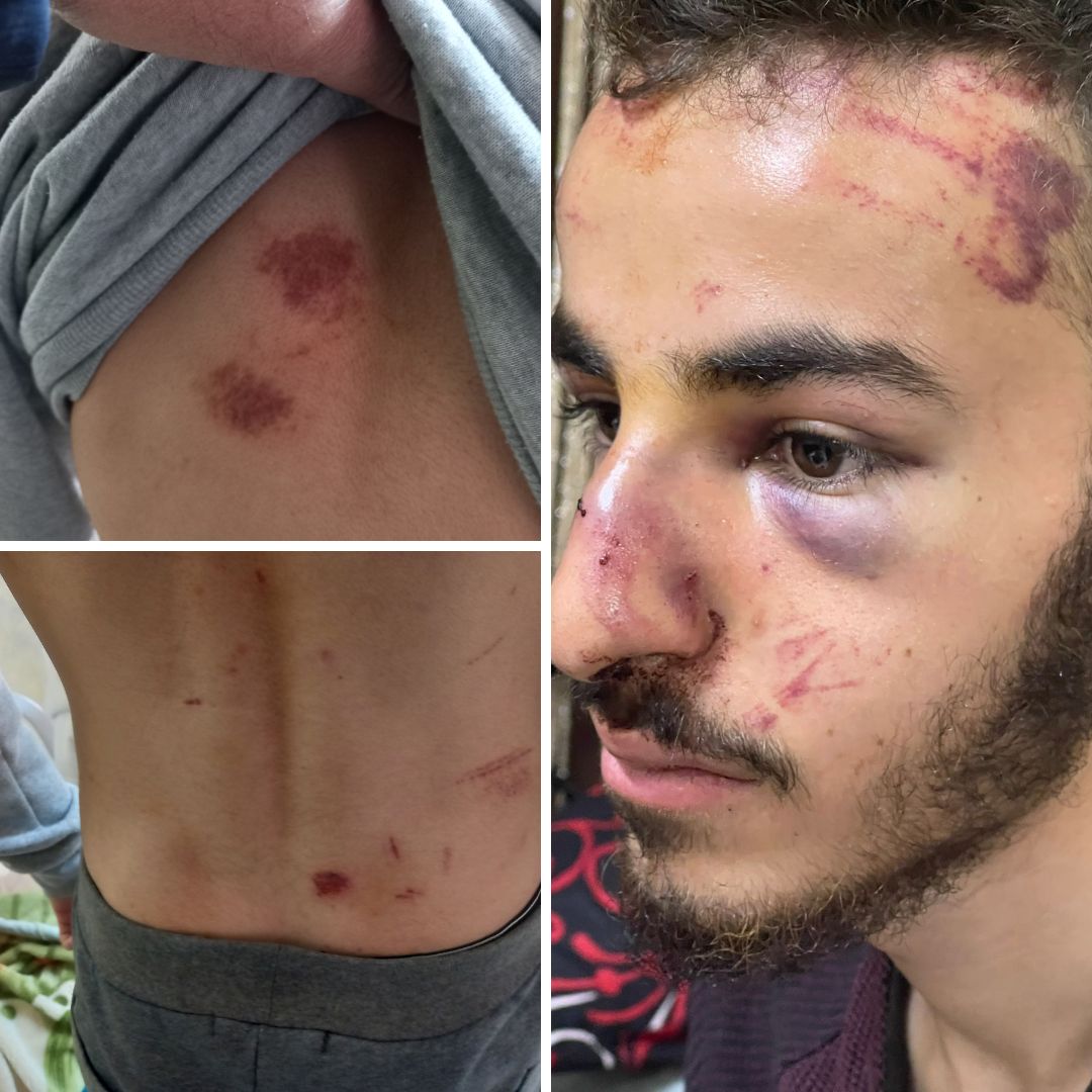 محمّد عبدو بعد إطلاق سراحه. تصوير عامر عاروري، بتسيلم, 20.3.23