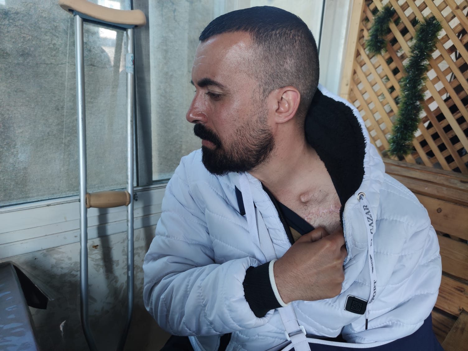 The dislodged platinum implant in ‘Abd al-Qader Tafesh’s chest. Photo: Olfat al-Kurd, B’Tselem, 7 Feb. 2024