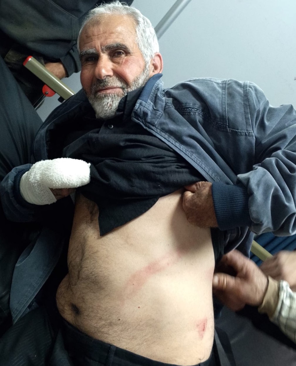 Mahmoud Hammad in the hospital, showing his bruises. Photo: Mohammad Romaneh, B’Tselem, 31 Dec. 2024