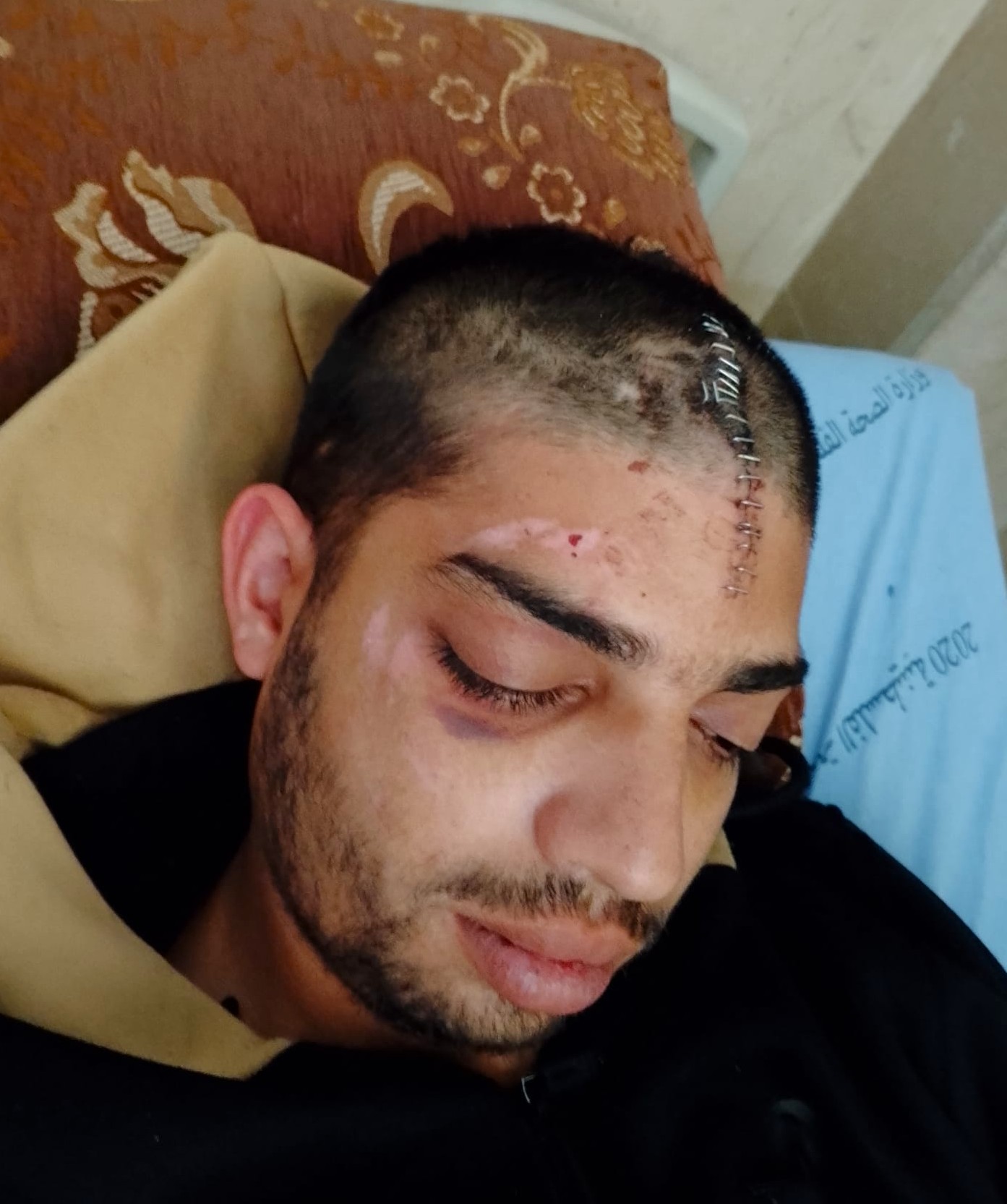 ممدوح سرور بعد اعتداء المستوطنين عليه. تصوير: محمّد رمّانة، بتسيلم