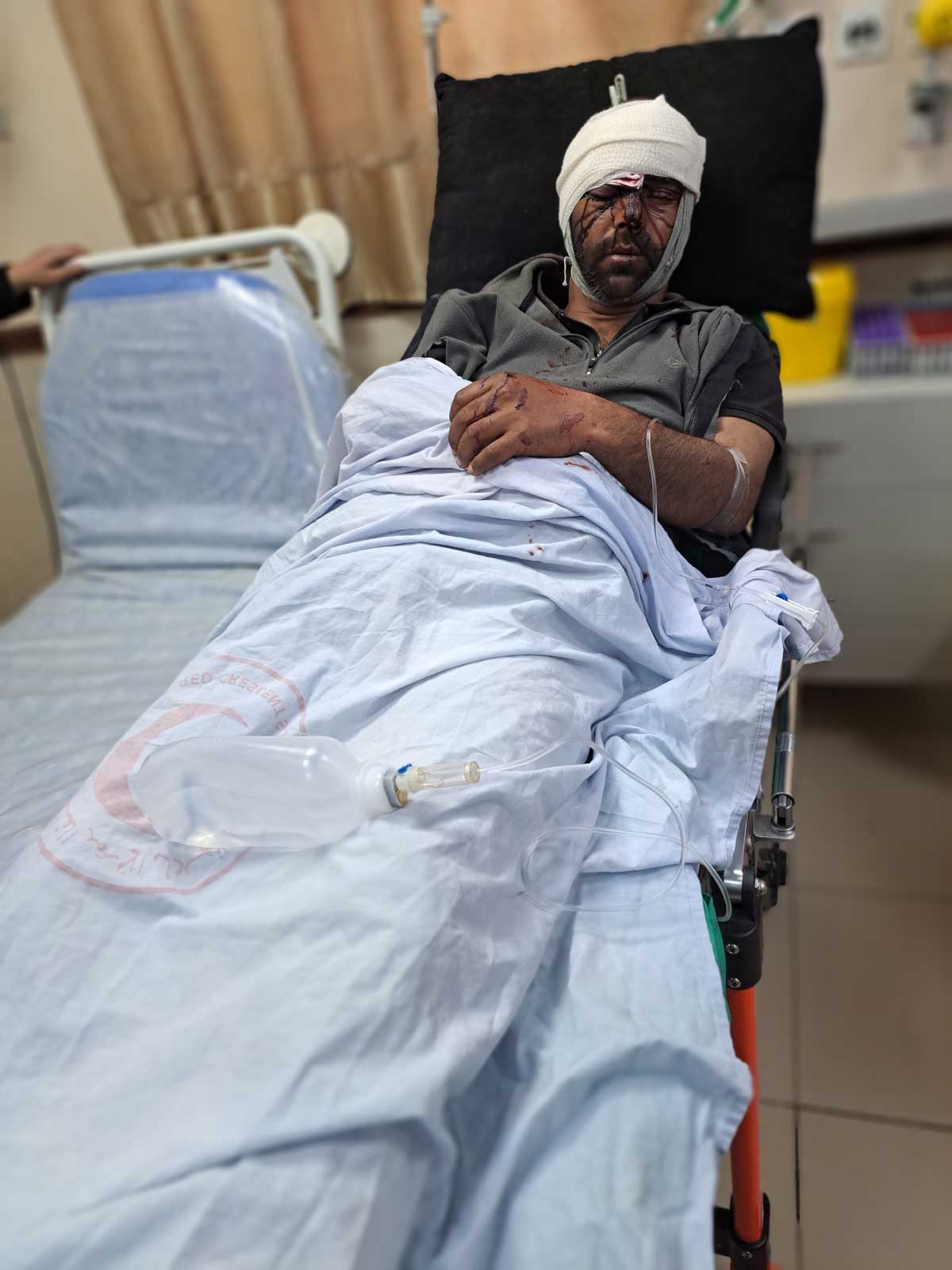 Ghanam al-Faqir in the hospital immediately after the attack. Photo: ‘Aref Daraghmeh, B’Tselem 