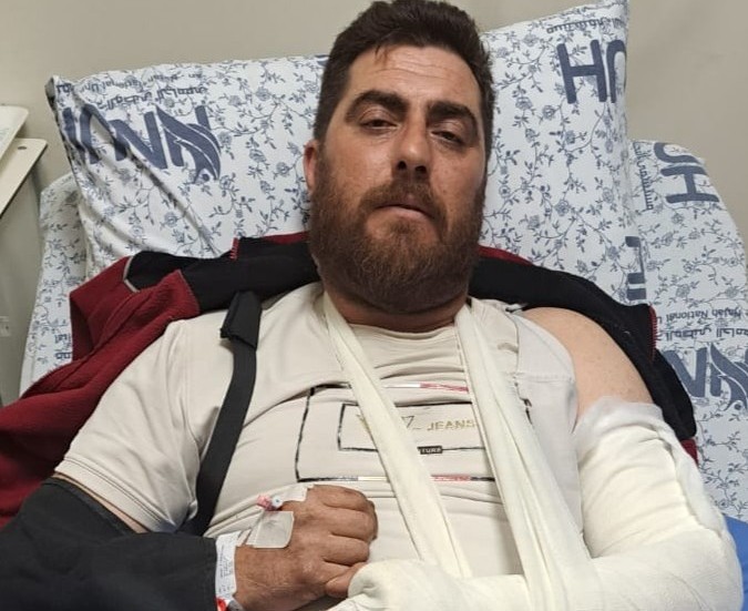 חסוני פרעונייה בבית החולים לאחר שהותקף על ידי מתנחלים באדמתו. צילום: סלמא א-דיבעי, בצלם