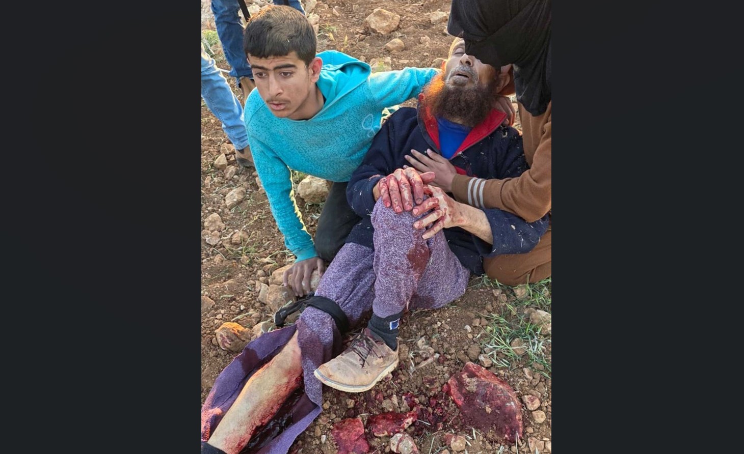 الشيخ سعيد وابنه الياس بعد إطلاق النار. صورة قدمتها العائلة مشكورة 