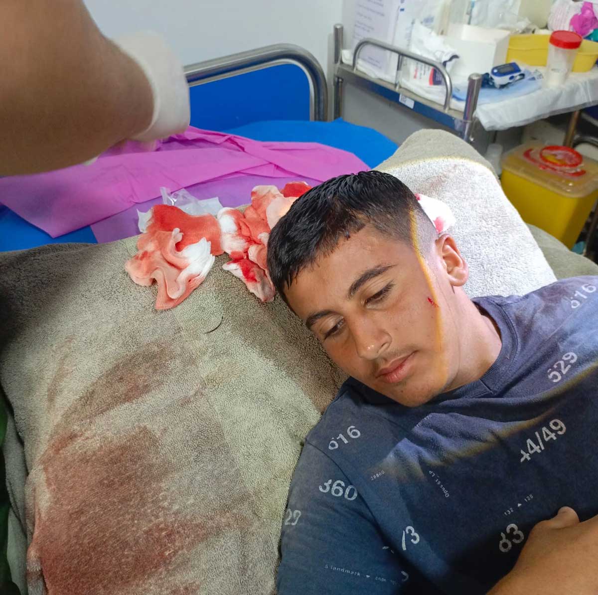 חבישת ראשו של מוסעב סוואטפה במרפאה. צילום: עארף דראר'מה, בצלם