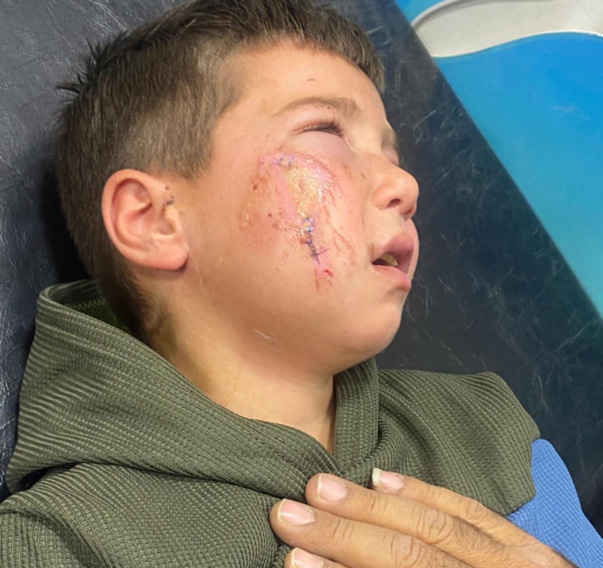 آدم الشنتير في المستشفى بعد تقديم العلاج له. صورة قدمتها العائلة مشكورة