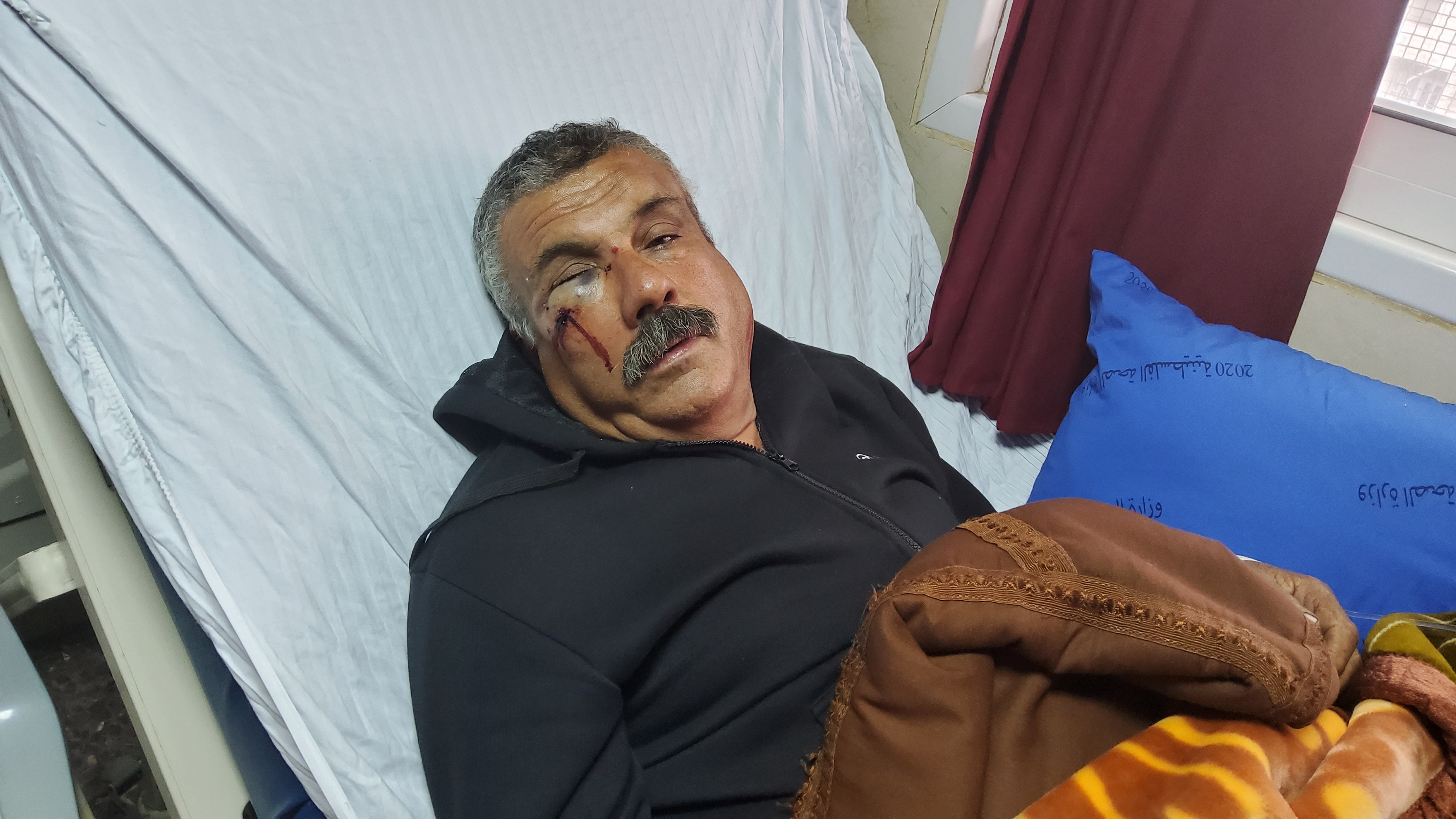Waael Muqbal in hospital. Photo by Salma a-Deb’i, B’Tselem, 17 Dec. 2021