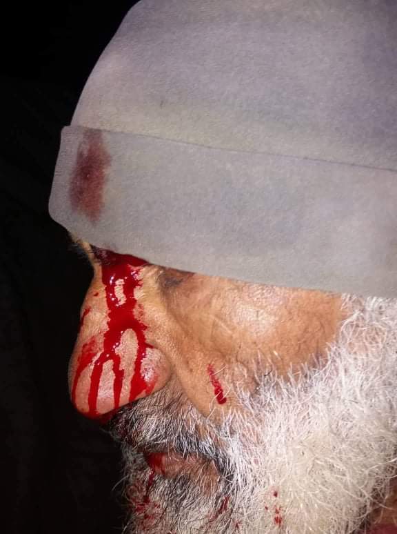 Khirbet Jab’it, 16 February and 5 March 2020, settlers assault shepherds and steal 25 lams