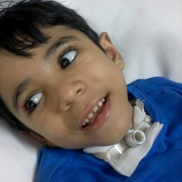 מוחמד אבו הדף לאחר פציעתו. התמונה באדיבות המשפחה