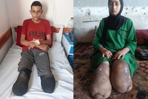 רימא וחסן אבו עייטה. התמונות באדיבות העד [ניתן להקליק להגדלה - שימו לב, תמונות קשות לצפייה]