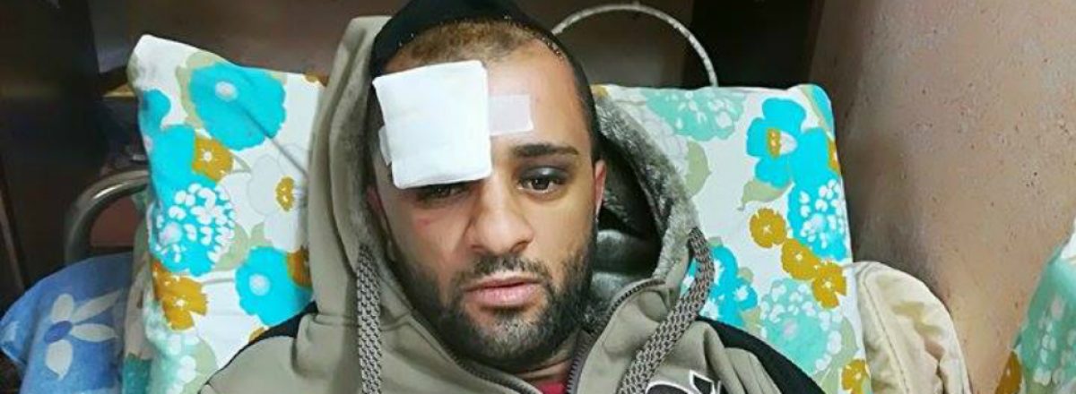 Muhammad Jarara at his home after being released from the hospital. Photo by Salma a-Deba'i, B'Tselem