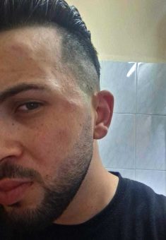 كدمات على وجه إسماعيل جابر. الصورة قدمها الشاهد مشكورًا.    