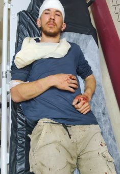 Mahmoud As’ad after being taken to the hospital. Photo: Salma a-Deb’i, B’Tselem