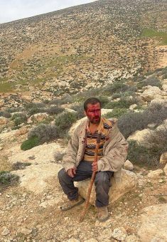 ماهر محمد بعد اعتداء المستوطنين عليه في أرضه. صورة قدمها الشاهد مشكورًا 