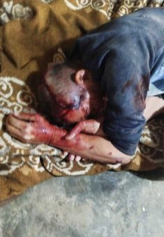 عزيز عمور بعد اعتداء المستوطنين عليه. صورة قدمها هو مشكورًا 
