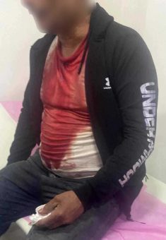 "ر. ش." بعد إخلائه إلى العيادة. الصورة قدمها هو مشكورًا