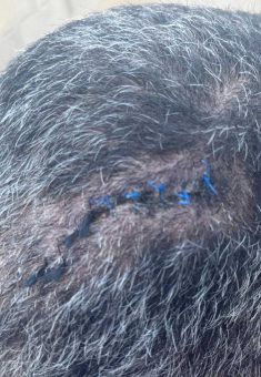 القُطَب في رأس "ر. ش.". الصورة قدمها هو مشكورًا