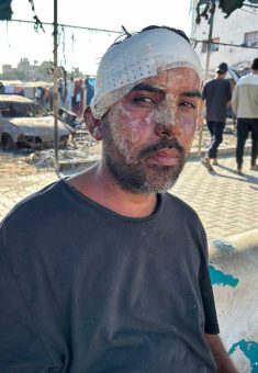 Ahmad a-Dalu after his injuries. Photo courtesy of the witness