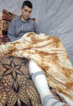 Hassan Nasrallah at home after the injury. Photo: Manal a-Ja’bari, B’Tselem 