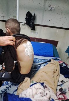 Yazan Rashdan’s bandaged back. Photo: Salma a-Deb’i, B’Tselem 