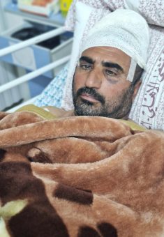 محمد أبو صبحة يرقد قيد العلاج في المستشفى.  تصوير: منال الجعبري، بتسيلم