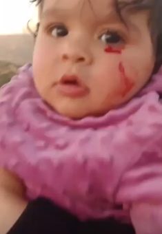 Sham Hassan after she was injured by settlers in Qusrah. Photo courtesy of the witness