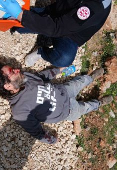 Oded Paporish after the assault by settlers in Qusrah. Photo courtesy of the activists