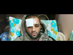 Muhammad Jarara at his home after being released from the hospital. Photo by Salma a-Deba'i, B'Tselem