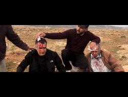  מוחמד זין א-דין, בן 70, ובנו עז א-דין, בן 46, תושבי מג'דל בני פאדל שבמחוז שכם, שהותקפו בידי מתנחלים חמושים באלות בדרכם לשדותיהם ב-13.1.21. צילום: הטלוויזיה הפלסטינית